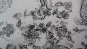 Electron microscope image of HIV, HTLV and Foamy viruses co-infection.